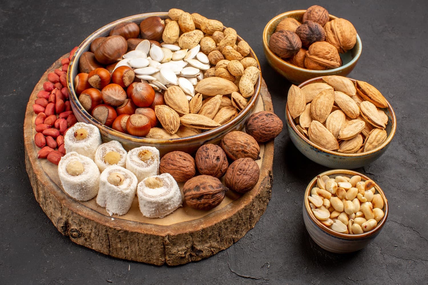 front-view-different-nuts-with-white-confitures-grey-surface_140725-74929 (1) front-view-different-nuts-with-white-confitures-grey-surface_140725-74929 (1)